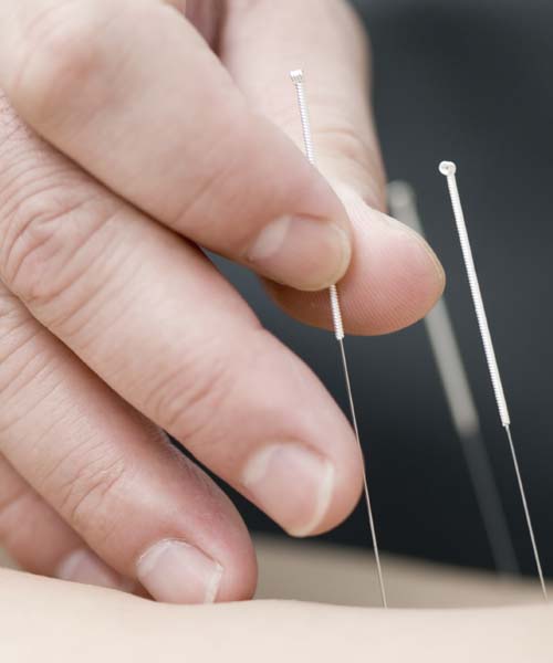 Hausärztliche Grundversorgung - Akupunktur